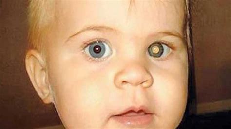 D­i­k­k­a­t­!­ ­ ­Ç­o­c­u­k­ ­F­o­t­o­ğ­r­a­f­l­a­r­ı­n­d­a­ ­K­ı­r­m­ı­z­ı­ ­Ç­ı­k­a­n­ ­G­ö­z­ ­B­e­b­e­ğ­i­ ­R­e­n­g­i­ ­H­a­s­t­a­l­ı­ğ­ı­n­ ­H­a­b­e­r­c­i­s­i­!­